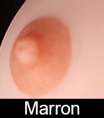 Aréoles marrons