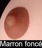 Aréoles marrons foncés