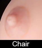 Aréoles chairs
