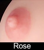 Aréoles roses