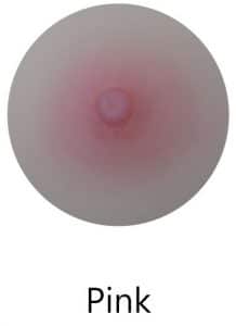 Pink areola