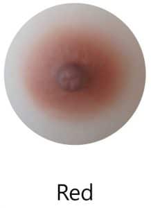 Red areolae